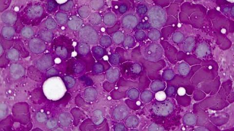 Gut Bacteria